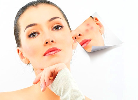 acne rimedi caratterische